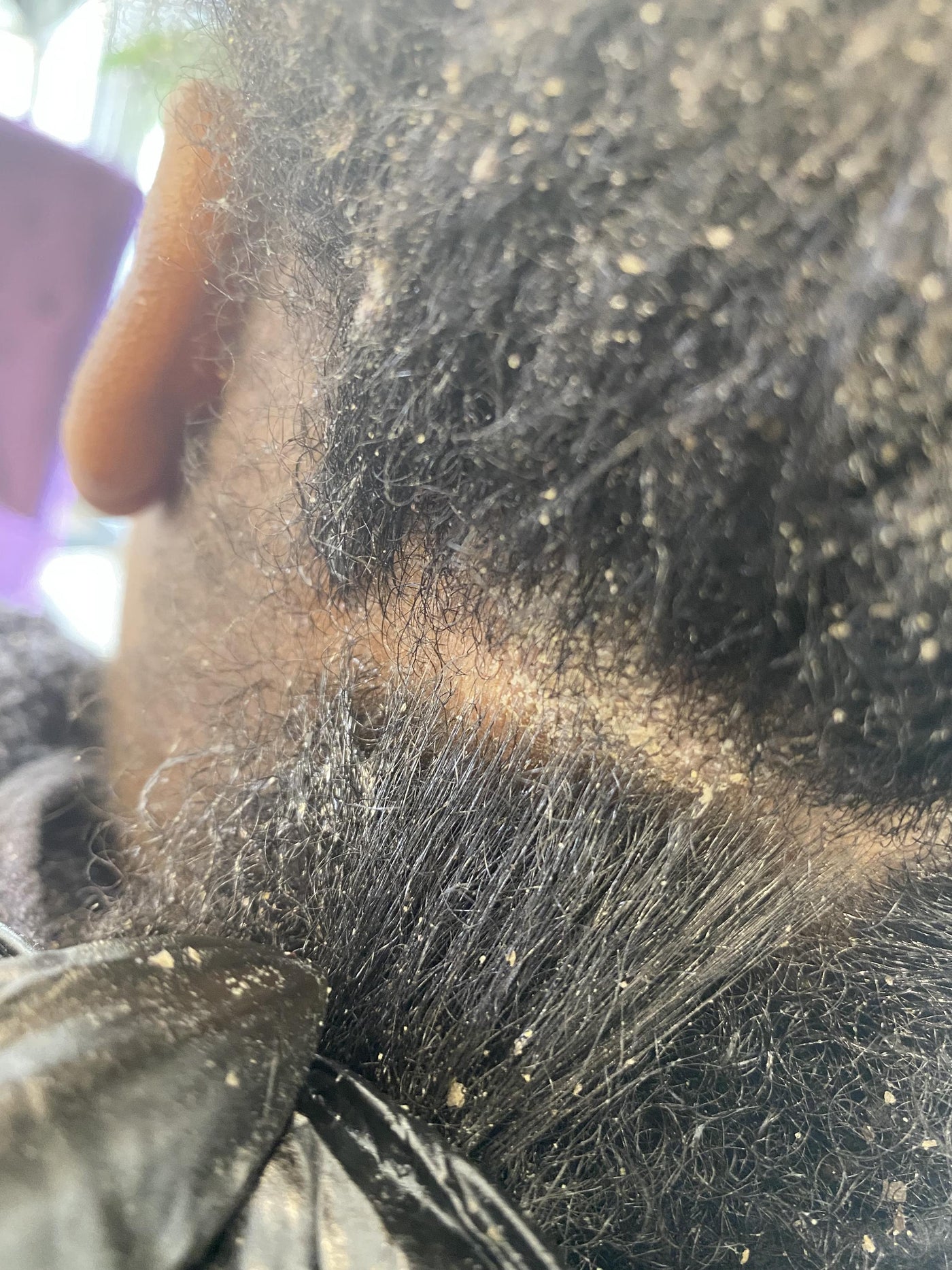 You Can Heal Your Scalp Guidebook Hair Divinity